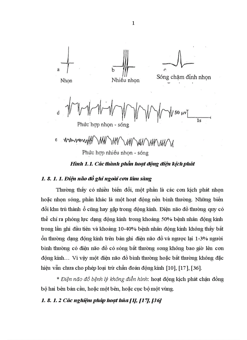 image for page Nghiên cứu đặc điểm lâm sàng điện não đồ hình ảnh học động kinh cơn lớn ở trẻ em tại khoa thần kinh bệnh viện bạch mai