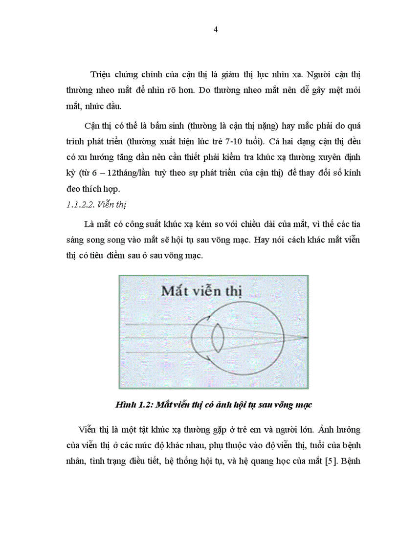 image for page Đánh giá sự ổn định thị lực sau mổ LASIK và một số yếu tố liên quan