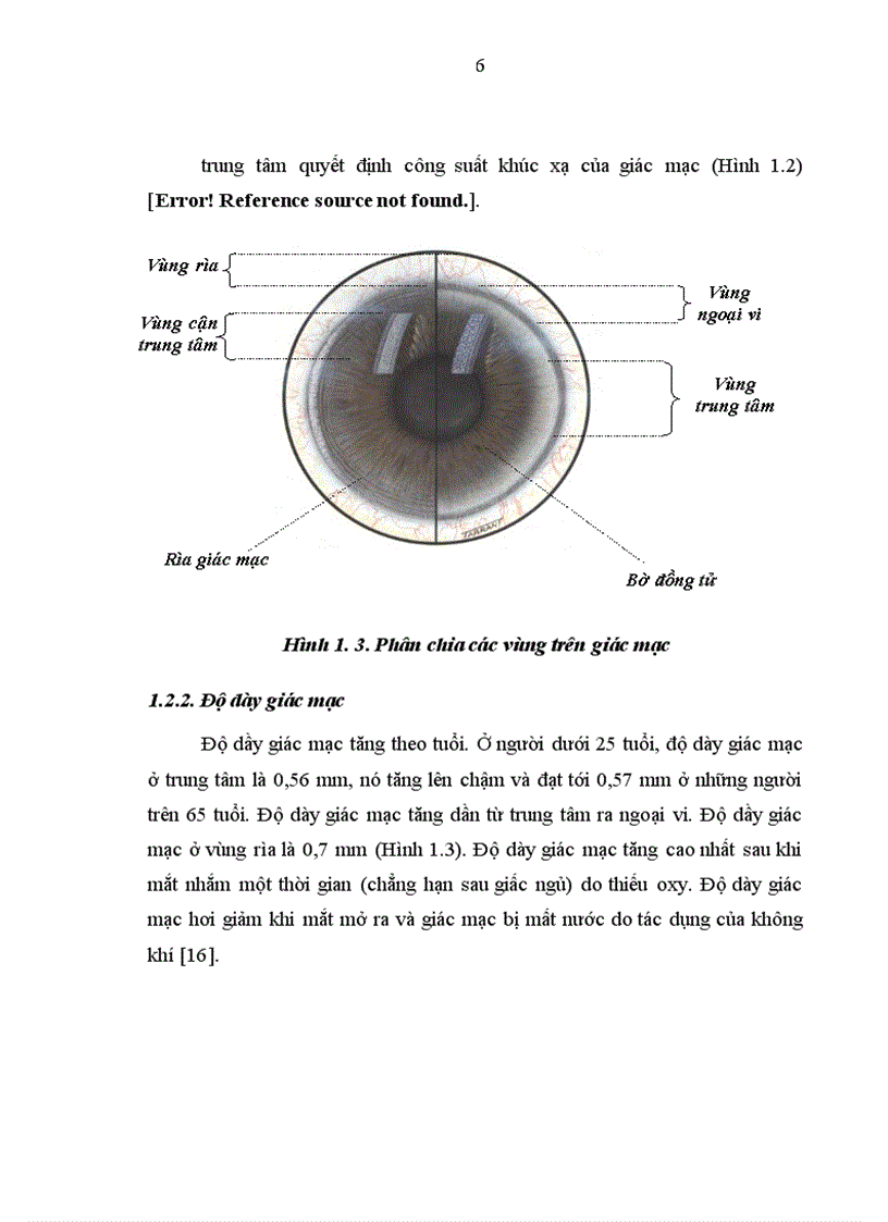 image for page Đánh giá sự ổn định thị lực sau mổ LASIK và một số yếu tố liên quan