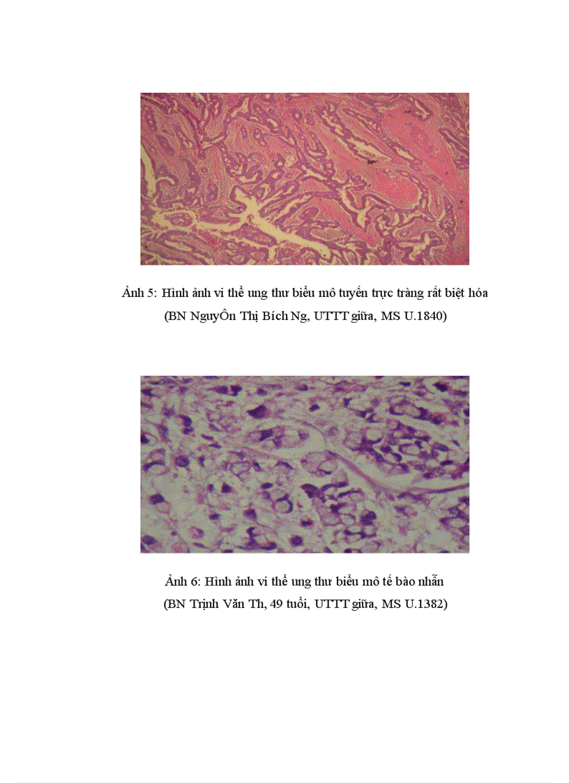 image for page Nghiên cứu mối liên quan giữa khối u với mức độ xâm lấn vào mạc treo của ung thư trực tràng