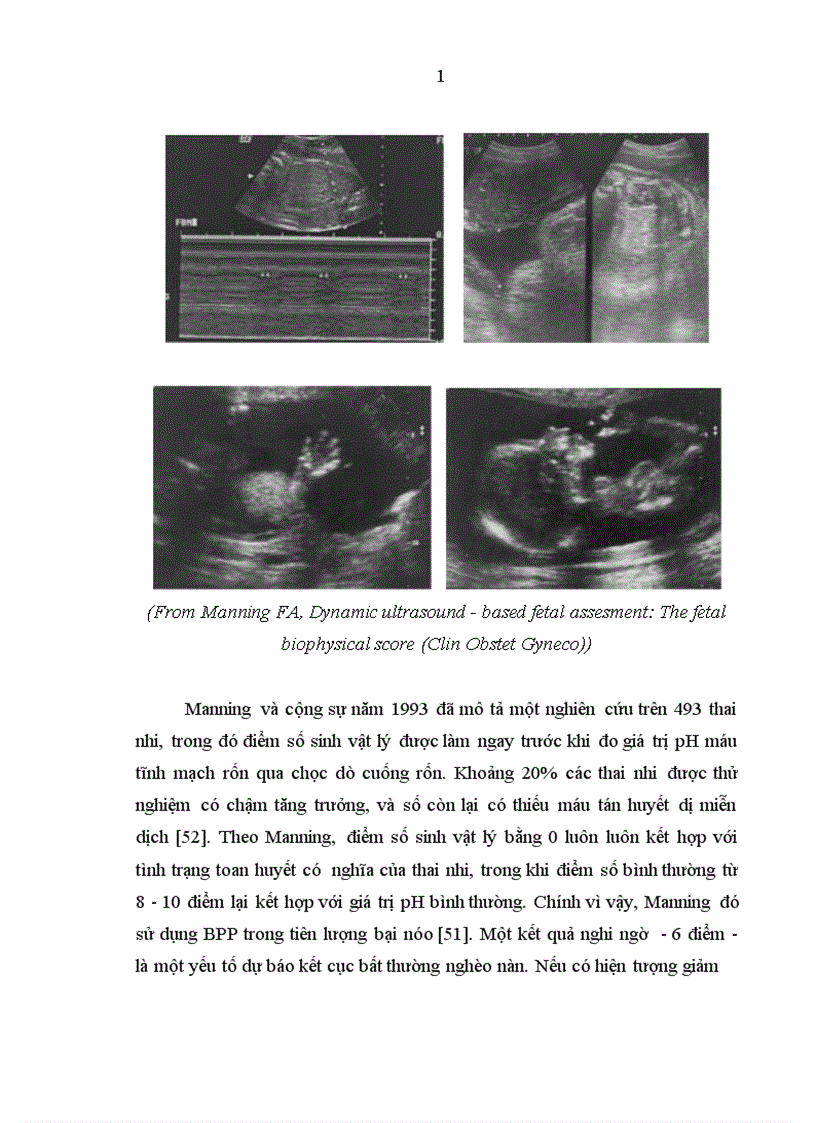 image for page Nghiên cứu ứng dụng chỉ số Manning trong đánh giá tình trạng sức khoẻ của thai ở thai phụ tiền sản giật tại bệnh viện Phụ sản Trung ương 1