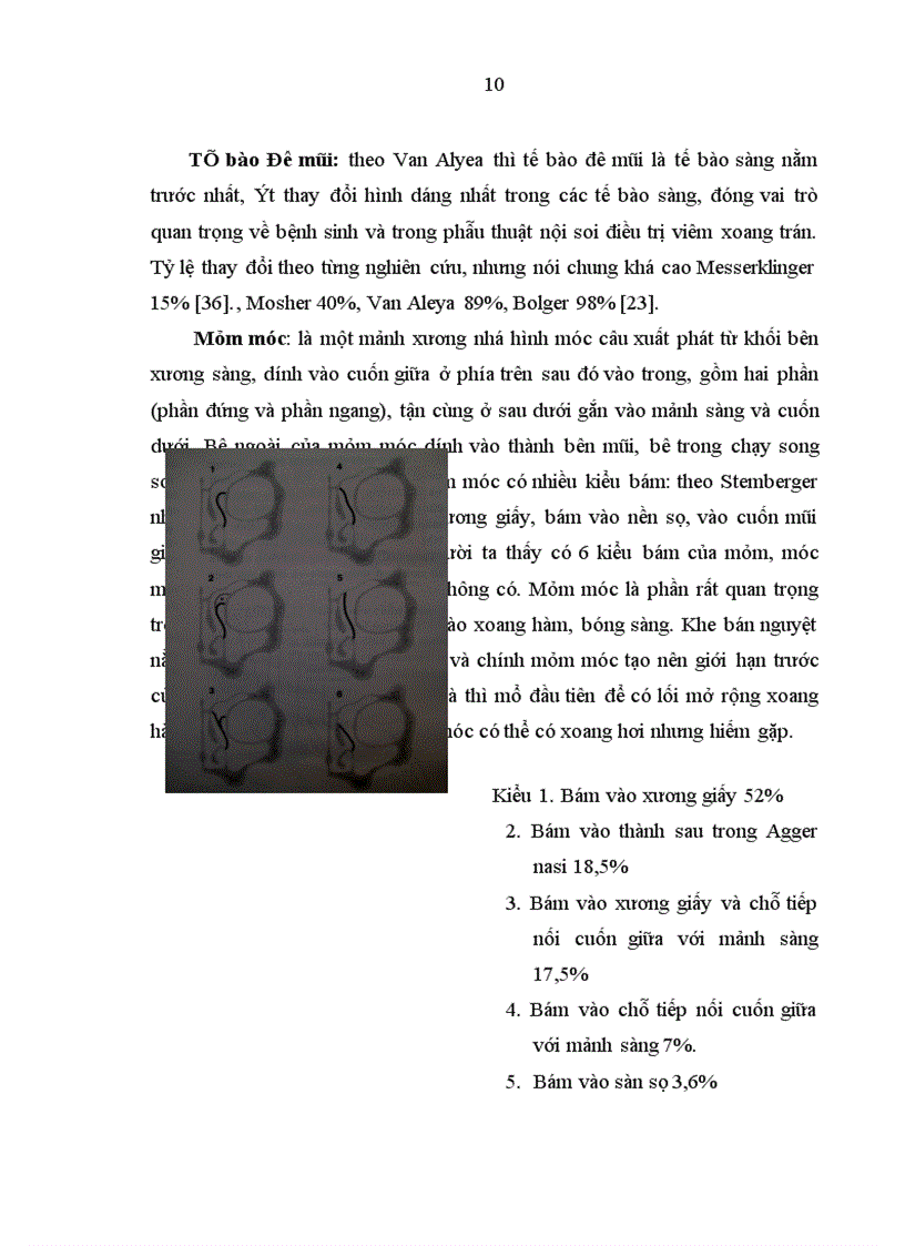 image for page Nghiên cứu hình thái lâm sàng của dị hình cuốn mũi giữa trong bệnh lý mũi xoang qua nội soi và chụp cắt lớp vi tính
