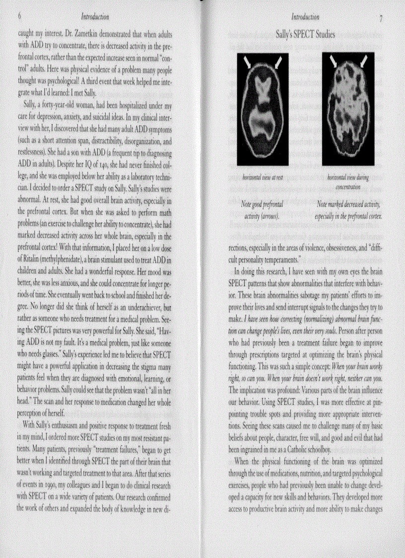 image for page Change Your Brain Change Your Life