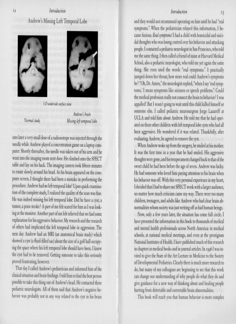 image for page Change Your Brain Change Your Life