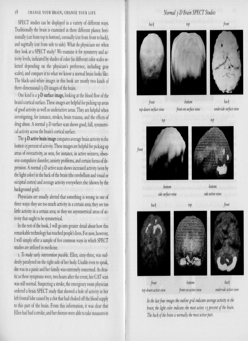 image for page Change Your Brain Change Your Life