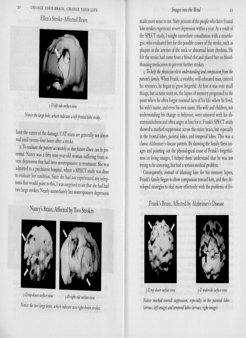 image for page Change Your Brain Change Your Life