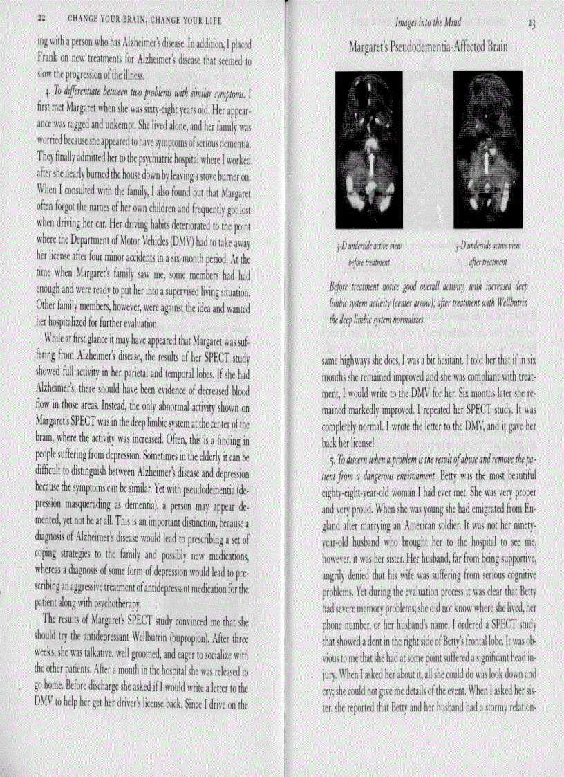 image for page Change Your Brain Change Your Life