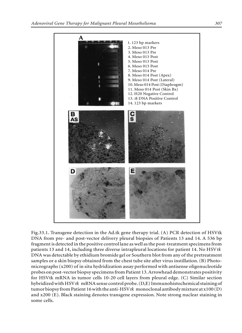 image for page Adenoviruses Basic Biology to Gene Therapy