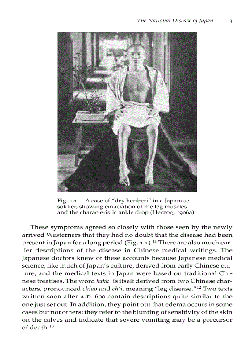 image for page Beriberi White Rice and Vitamin B