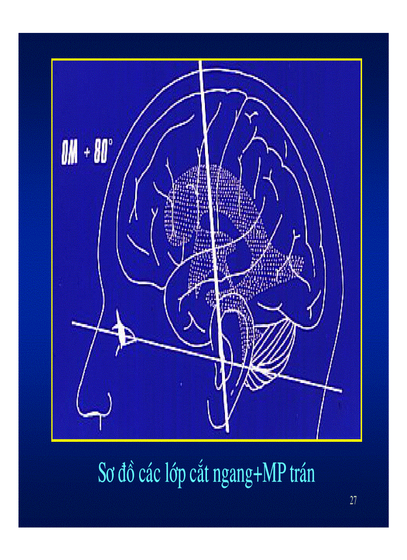 image for page Giải phẫu thần kinh đối chiếu chẩn đoán hình ảnh