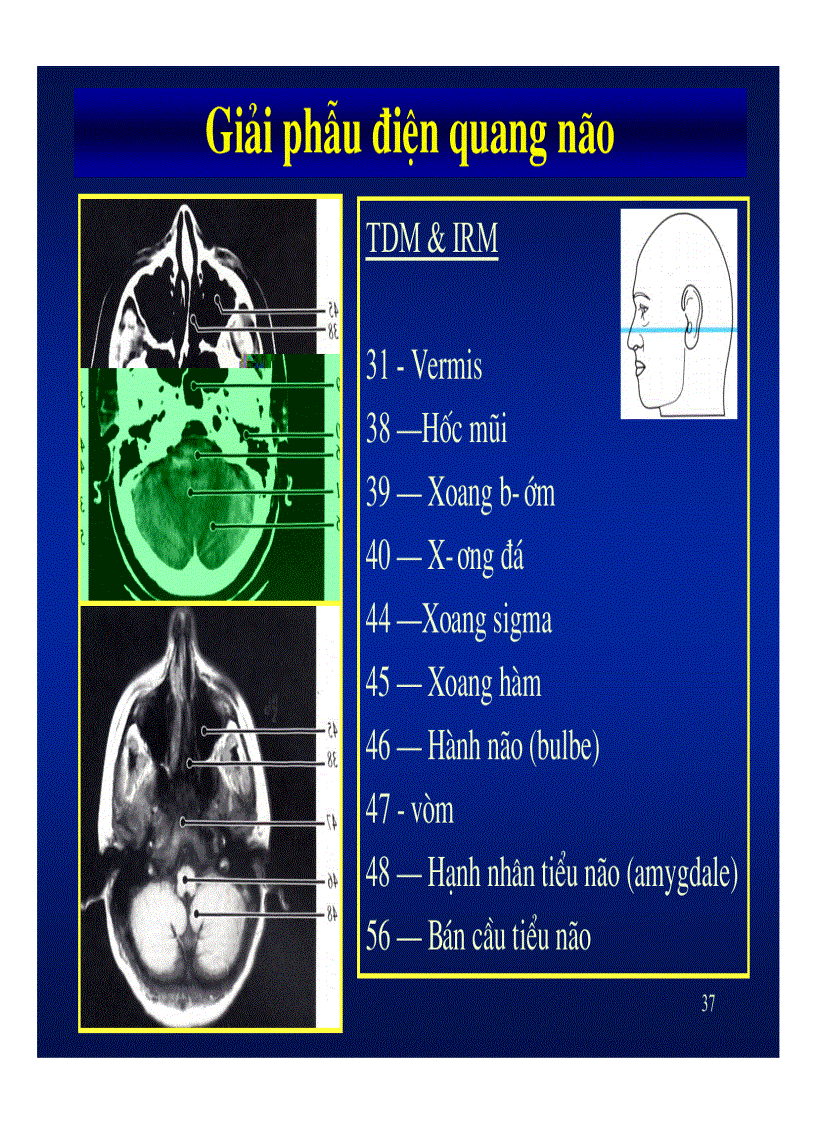 image for page Giải phẫu thần kinh đối chiếu chẩn đoán hình ảnh