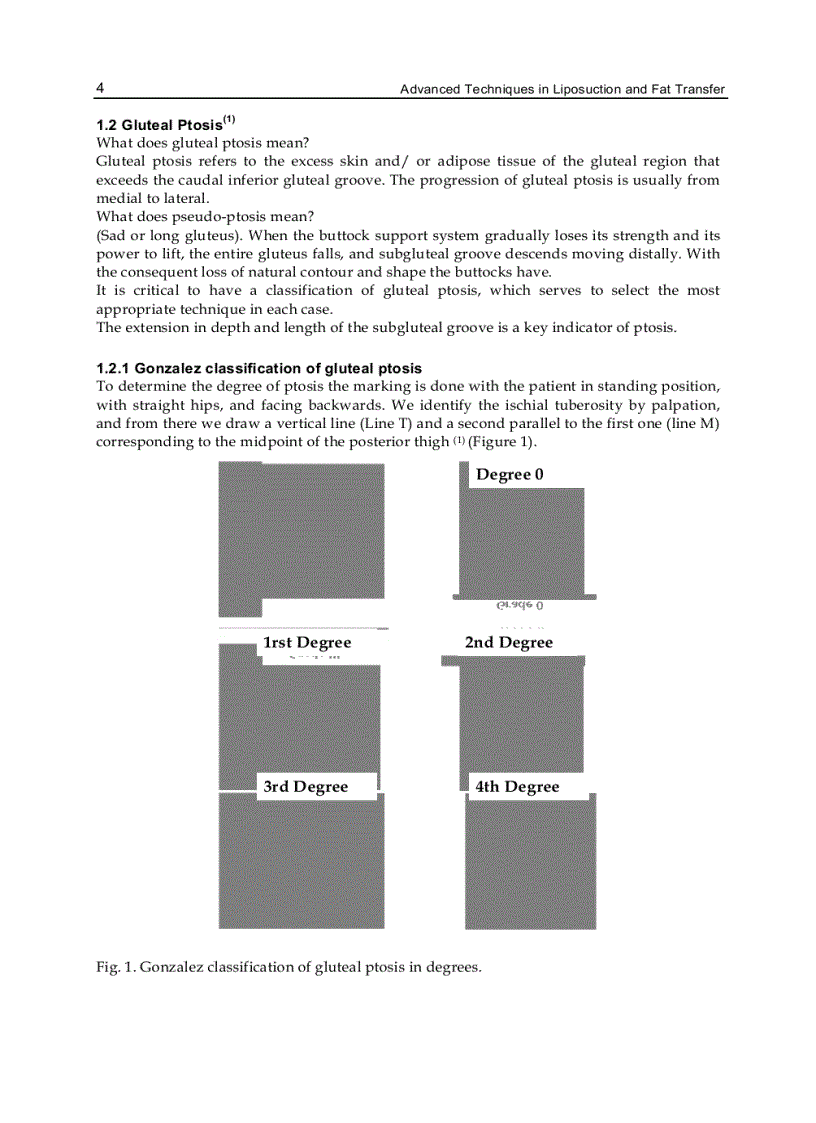 image for page Advanced Techniques in Liposuction and Fat Transfer