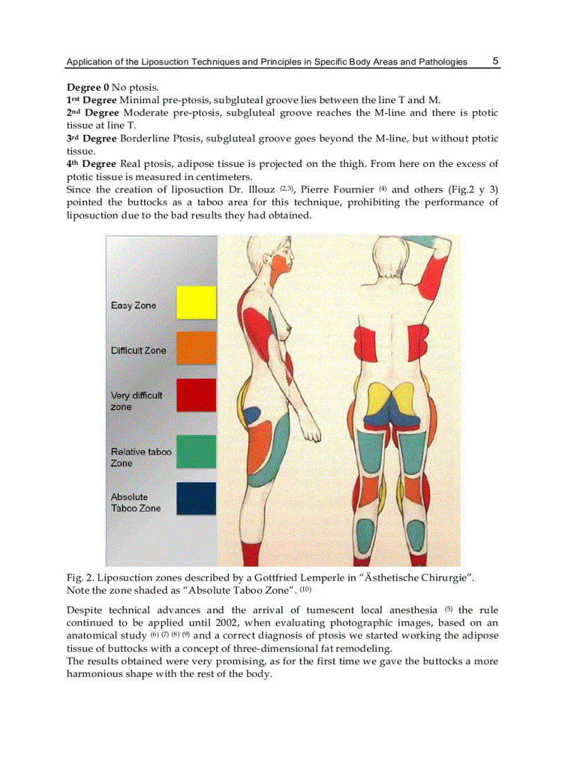 image for page Advanced Techniques in Liposuction and Fat Transfer