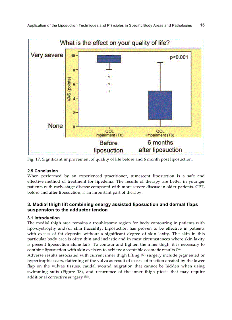 image for page Advanced Techniques in Liposuction and Fat Transfer