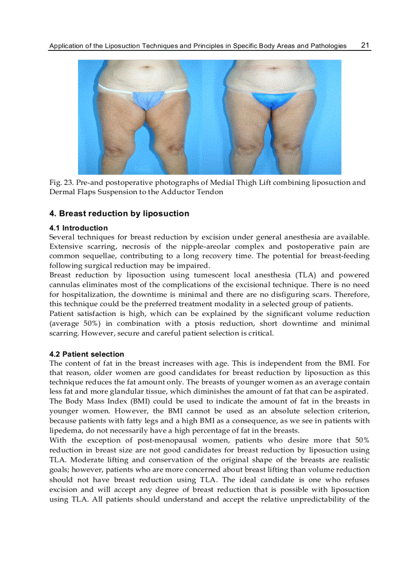 image for page Advanced Techniques in Liposuction and Fat Transfer