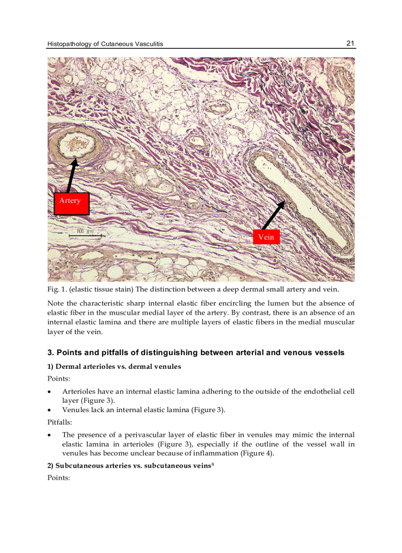 image for page Advances in the Diagnosis and Treatment of Vasculitis