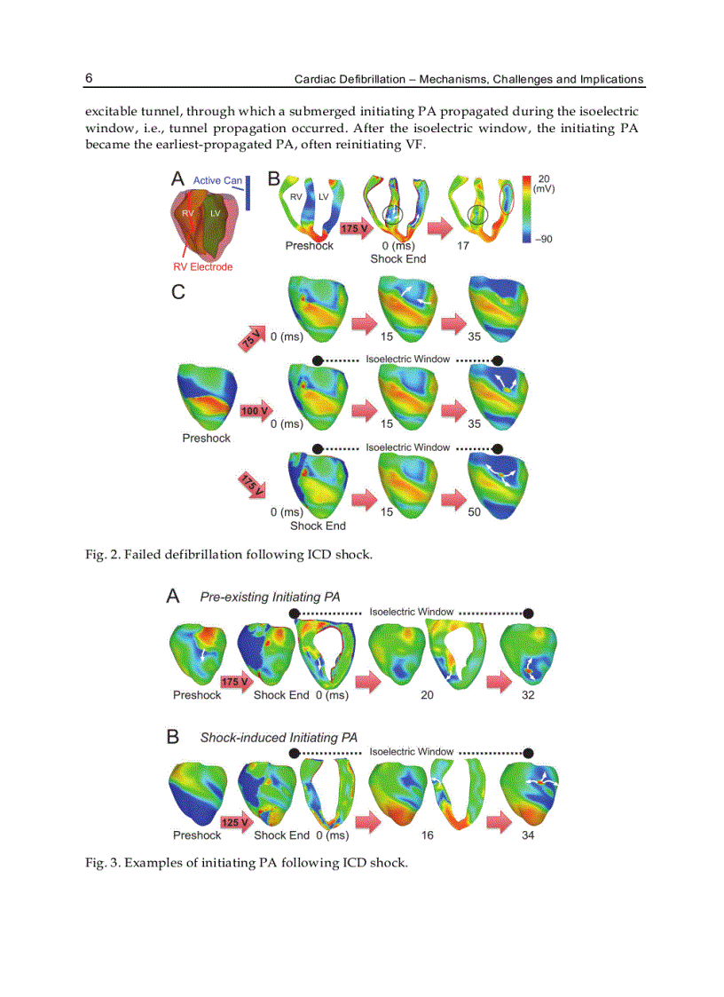 image for page Cardiac Defibrillation Mechanisms Challenges and Implications