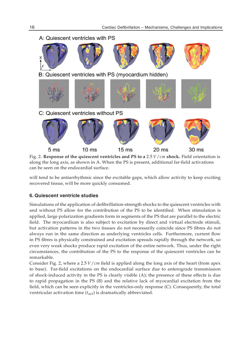 image for page Cardiac Defibrillation Mechanisms Challenges and Implications