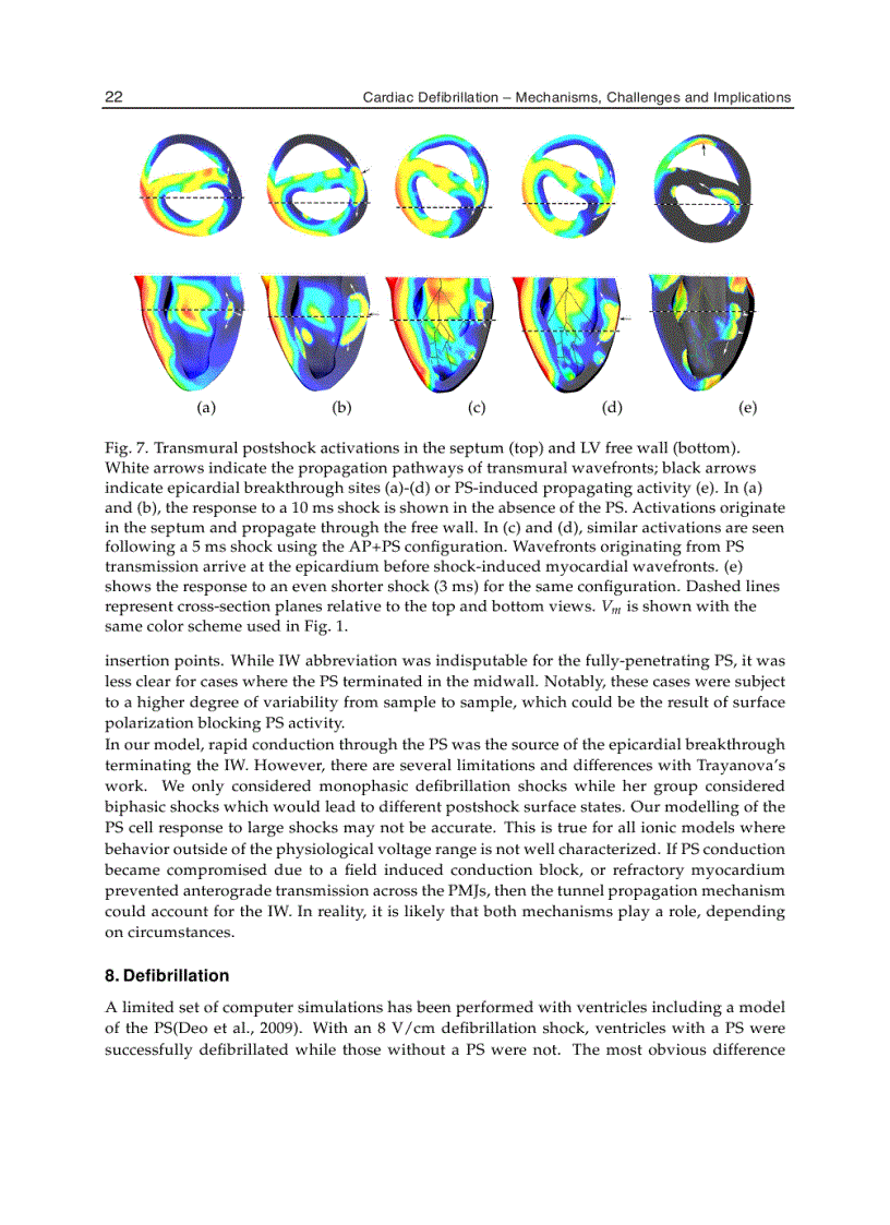 image for page Cardiac Defibrillation Mechanisms Challenges and Implications
