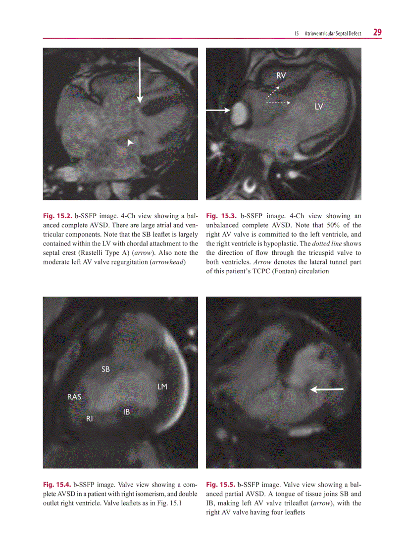 image for page Cardiovascular MRI in Congenital Heart Disease