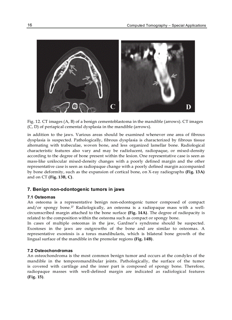 image for page Computed Tomography Special Applications