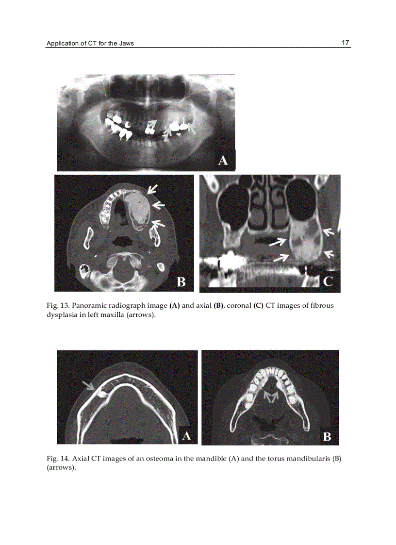image for page Computed Tomography Special Applications