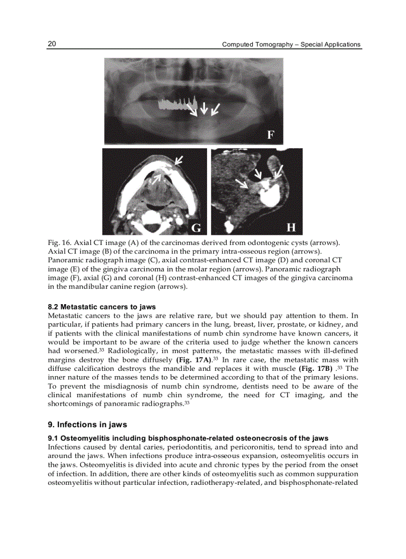 image for page Computed Tomography Special Applications
