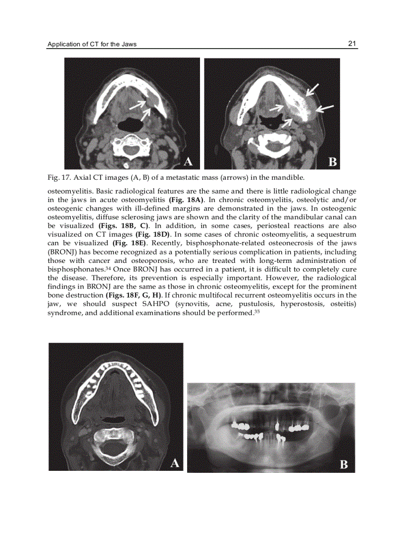 image for page Computed Tomography Special Applications