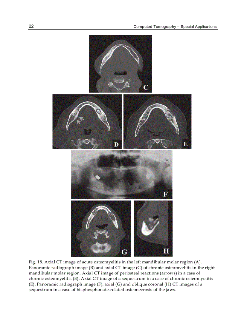 image for page Computed Tomography Special Applications