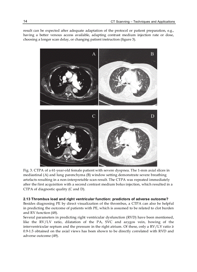 image for page CT Scanning Techniques and Applications