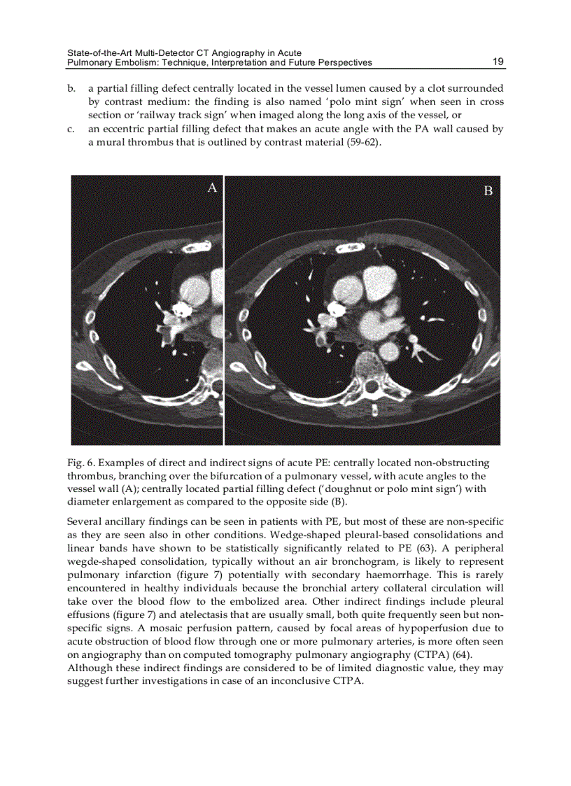 image for page CT Scanning Techniques and Applications