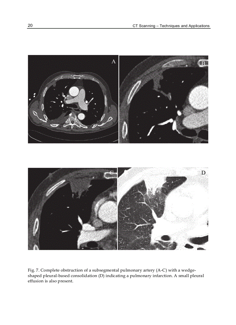 image for page CT Scanning Techniques and Applications