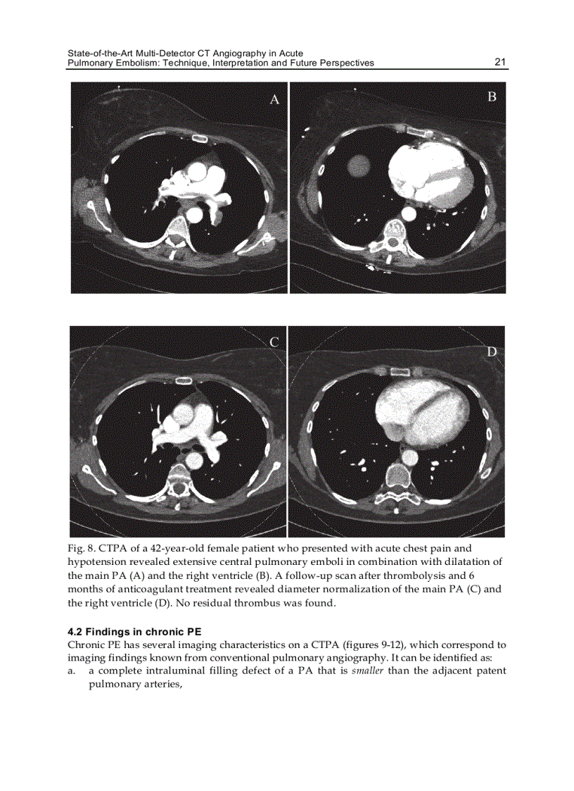image for page CT Scanning Techniques and Applications