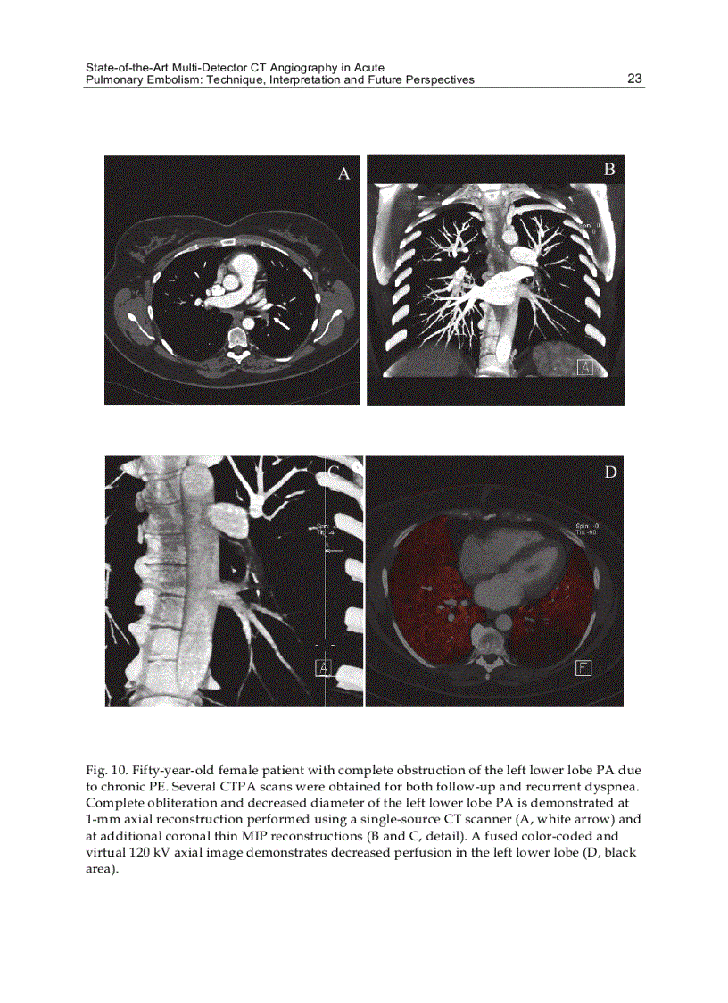 image for page CT Scanning Techniques and Applications