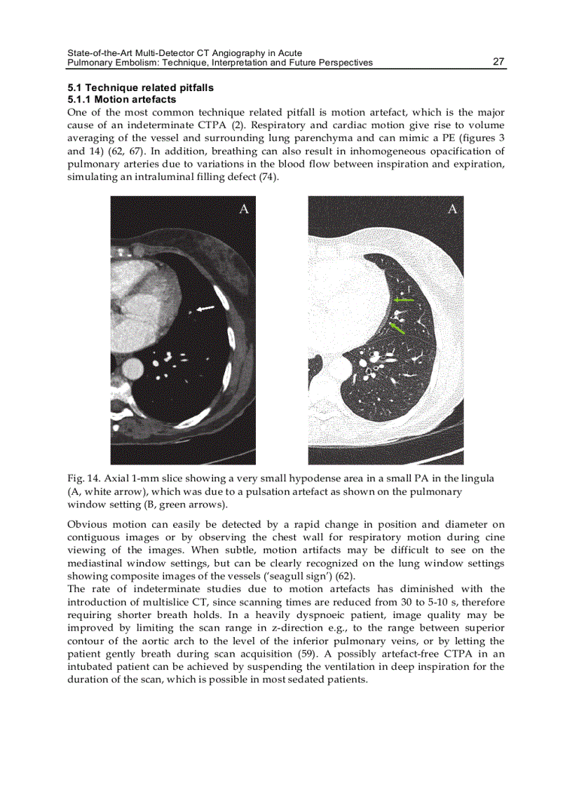 image for page CT Scanning Techniques and Applications