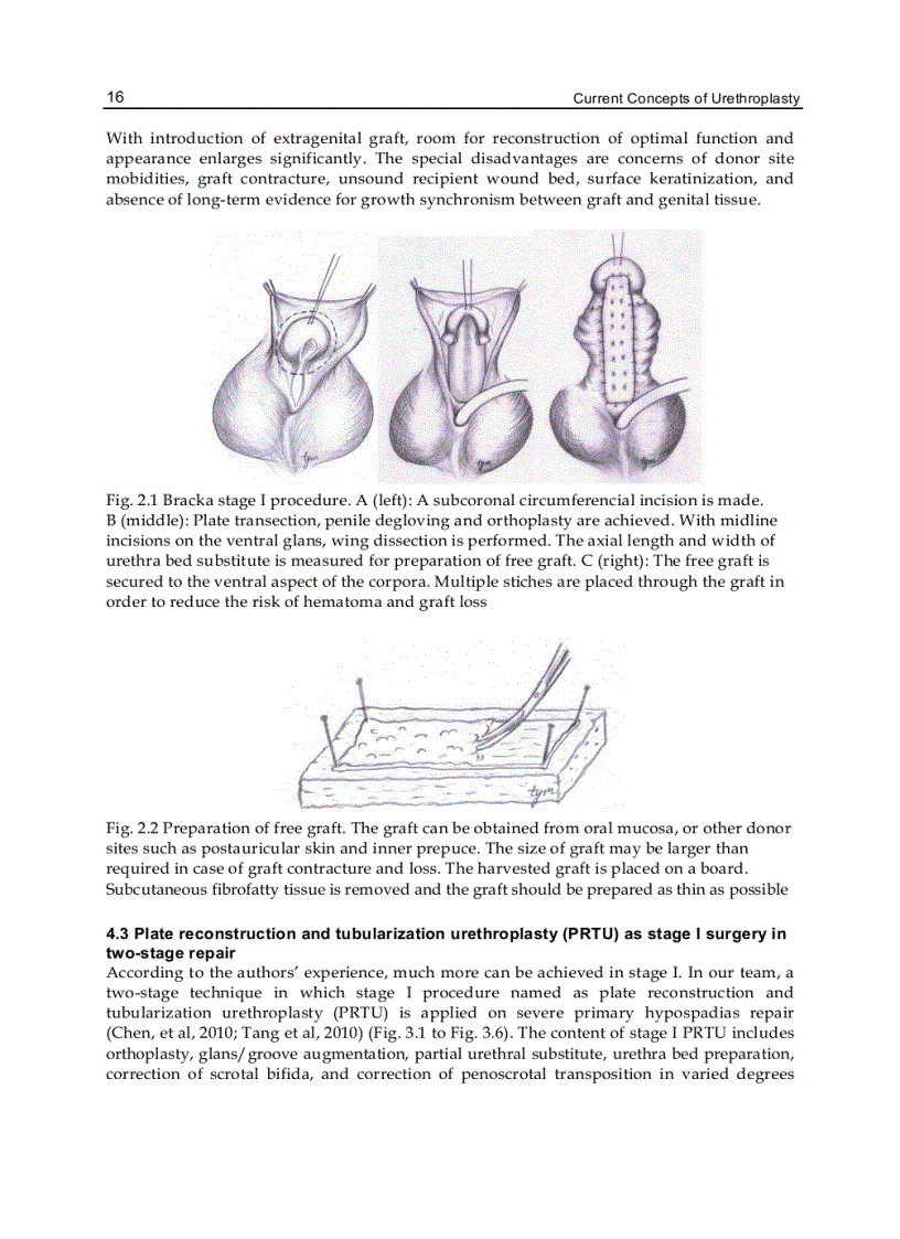 image for page Current Concepts of Urethroplasty