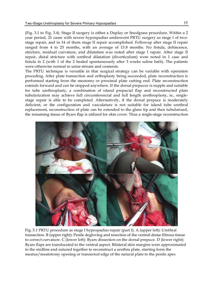 image for page Current Concepts of Urethroplasty