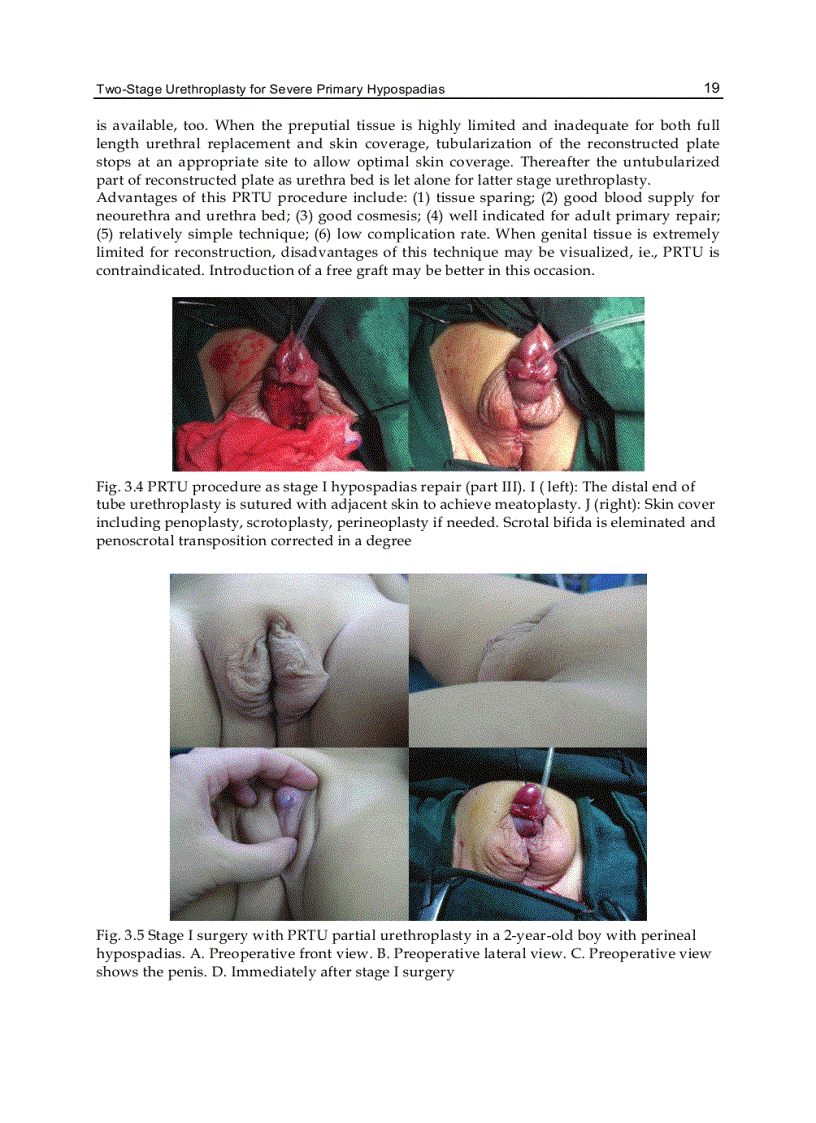 image for page Current Concepts of Urethroplasty