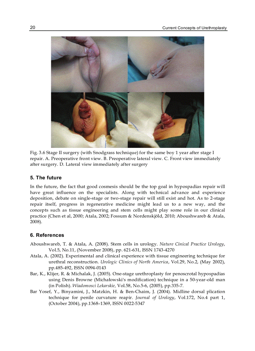 image for page Current Concepts of Urethroplasty