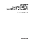 Current Management of Malignant Melanoma