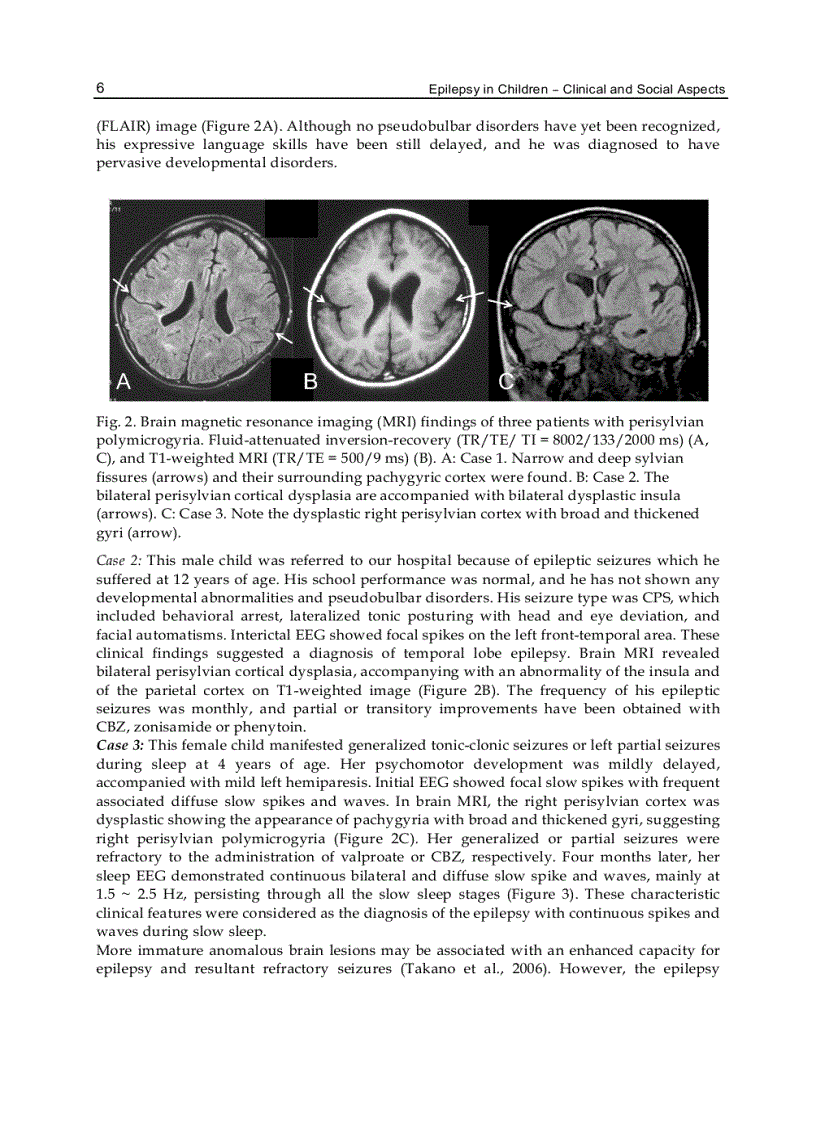 image for page Epilepsy in Children Clinical and Social Aspects