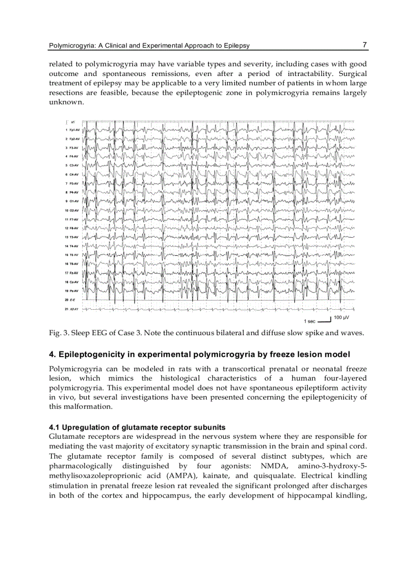 image for page Epilepsy in Children Clinical and Social Aspects