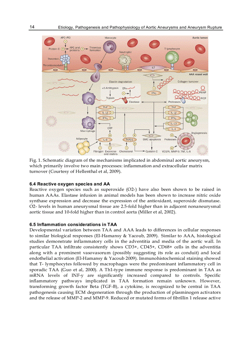 image for page Etiology Pathogenesis and Pathophysiology of Aortic Aneurysms and Aneurysm Rupture
