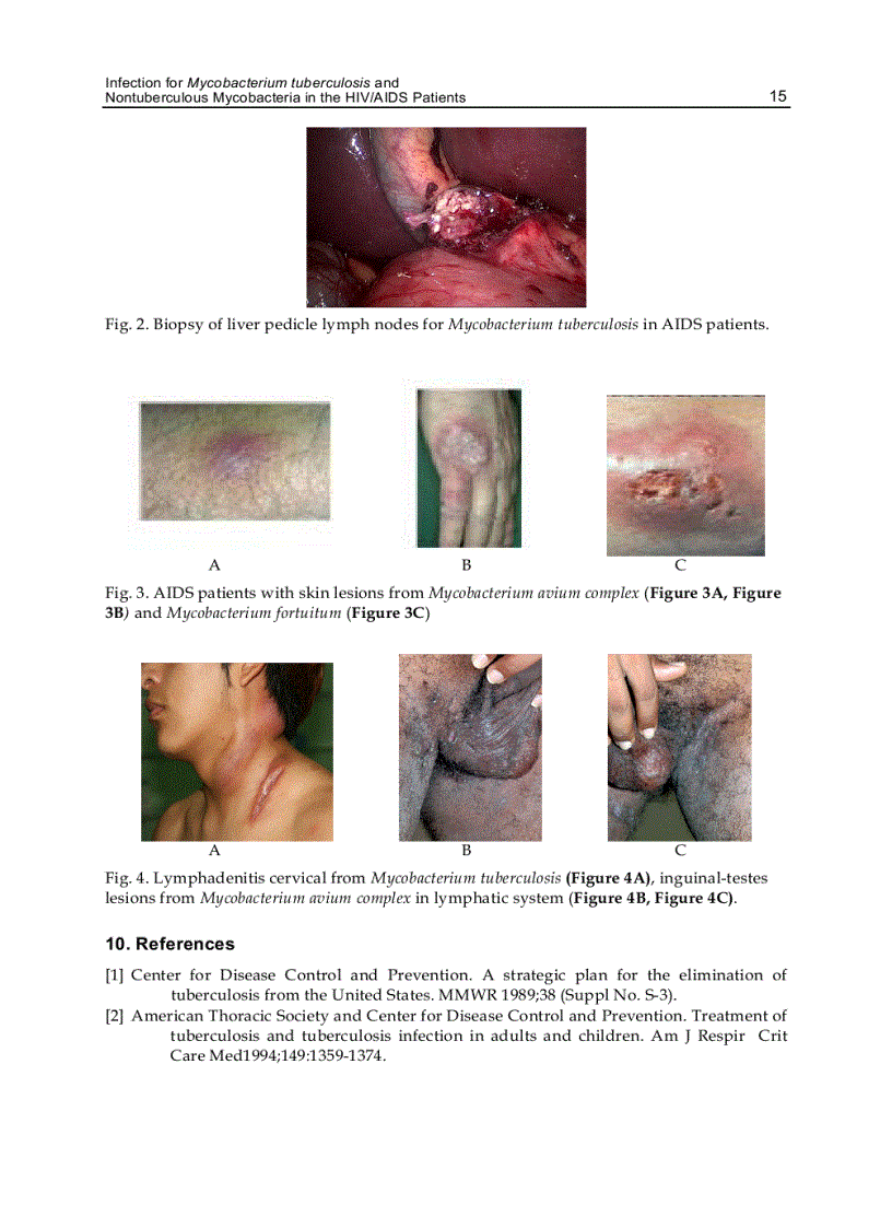 image for page Global View of HIV Infection