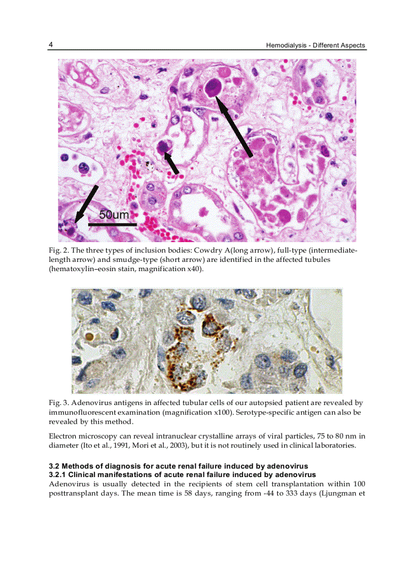 image for page Hemodialysis Different Aspects