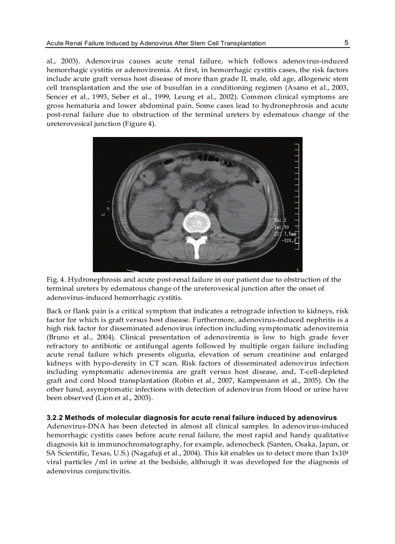 image for page Hemodialysis Different Aspects
