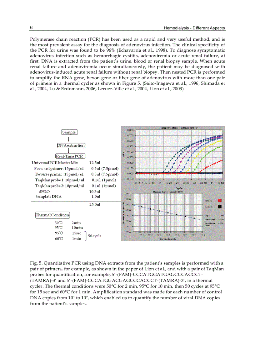 image for page Hemodialysis Different Aspects