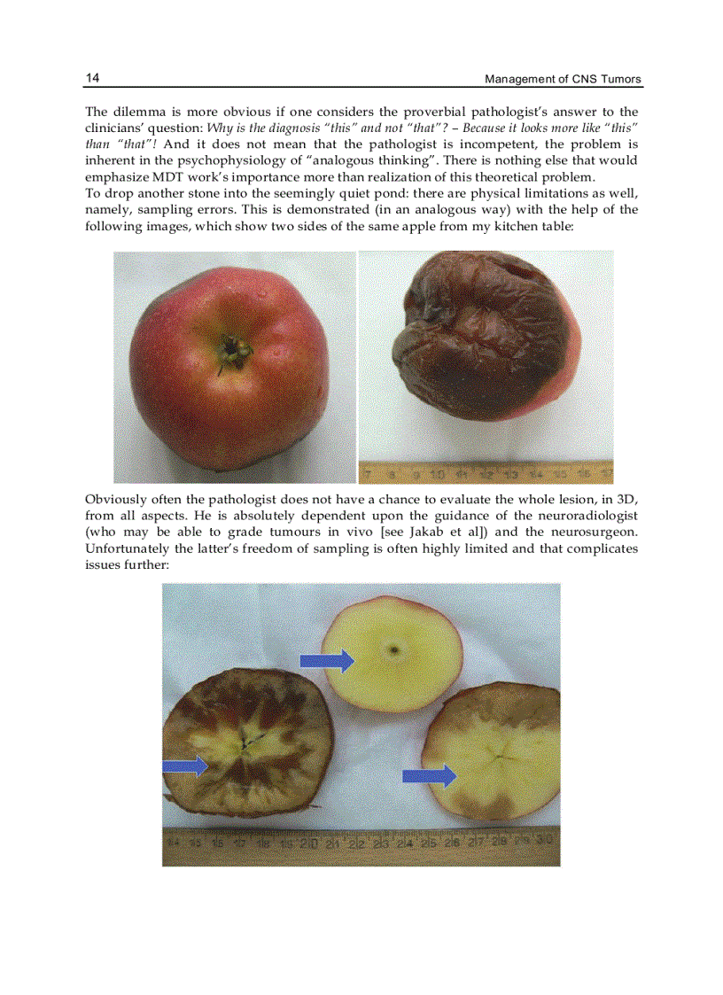 image for page Management of CNS Tumors