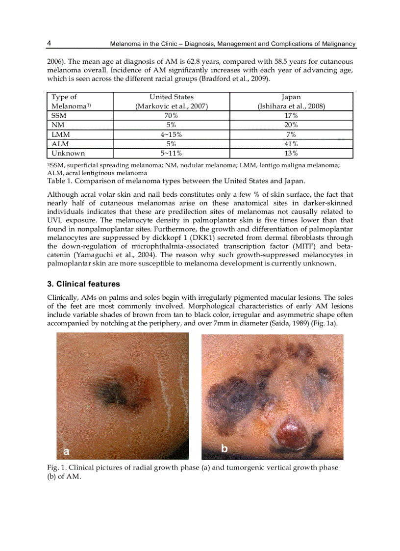 image for page Melanoma in the Clinic Diagnosis Management and Complications of Malignancy