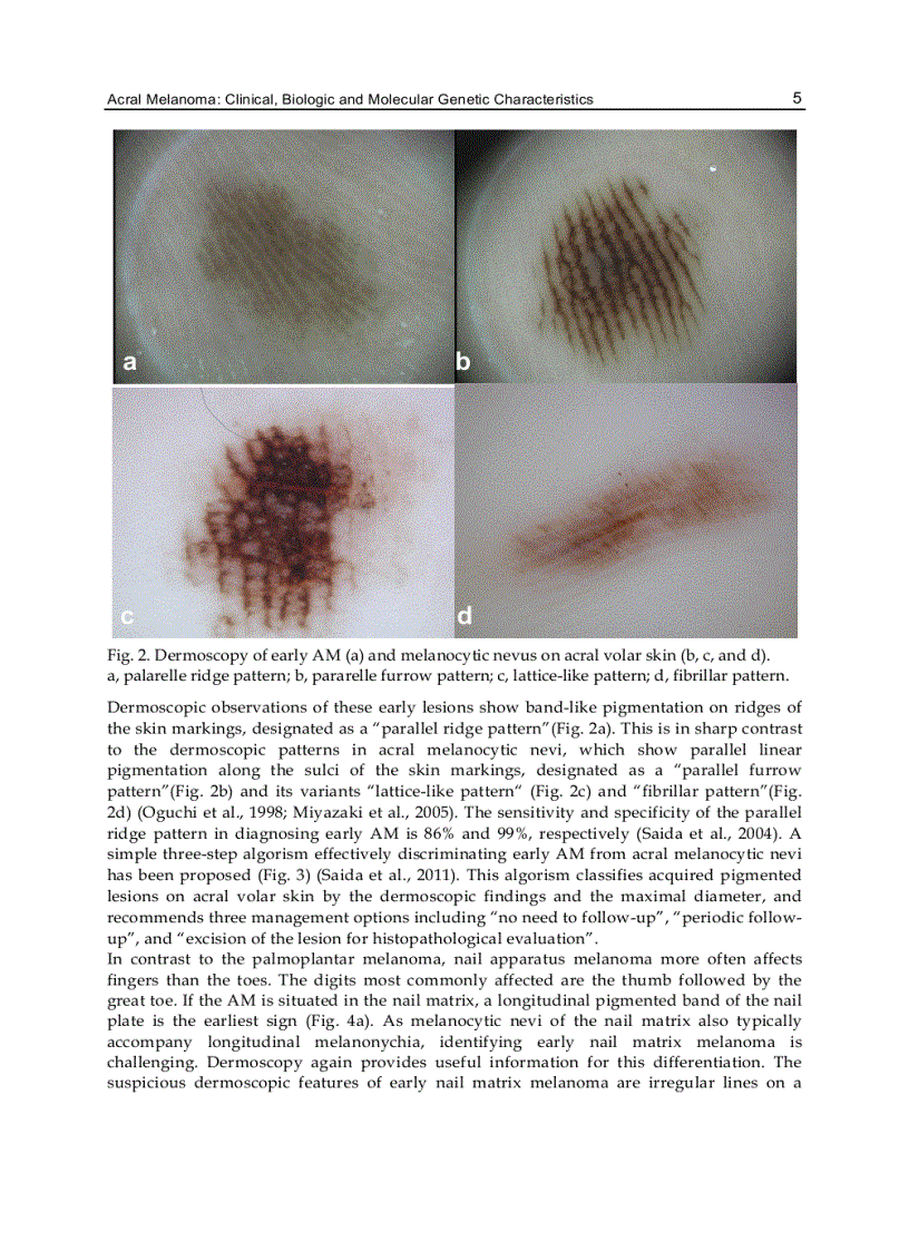 image for page Melanoma in the Clinic Diagnosis Management and Complications of Malignancy